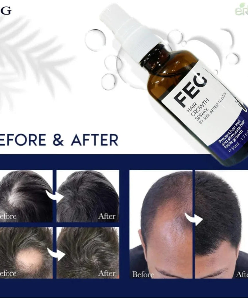Feg Hair Growth Spray